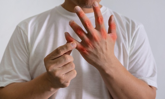 Gdzie boli przy dnie moczanowej?