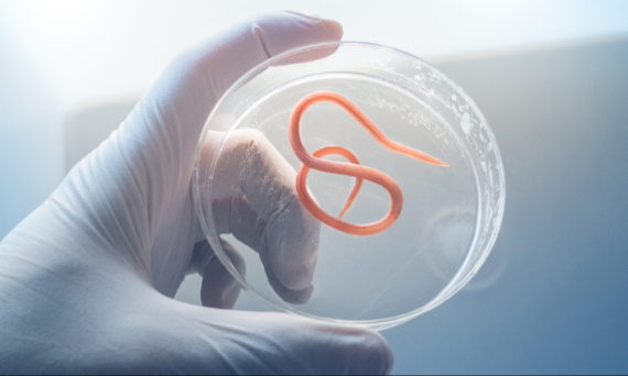 Co daje oczyszczanie organizmu?