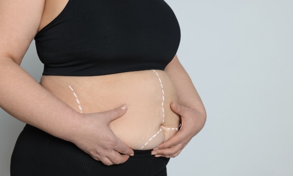 Jak wygląda dieta po operacji bariatrycznej?