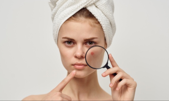 Palma sabałowa – nie tylko na wypadanie włosów!