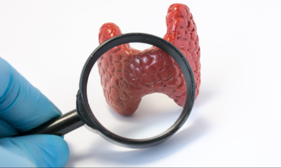 Czy tarczyca jest dziedziczna?